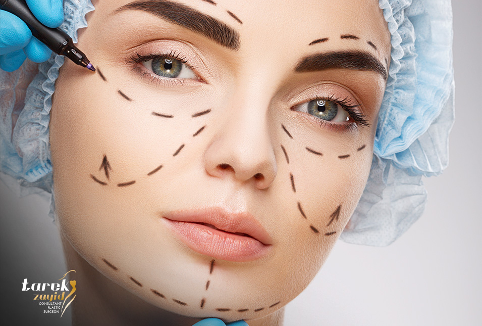الخيوط التجميلية